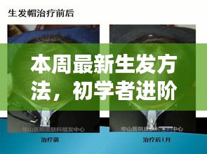 初學(xué)者進(jìn)階指南，掌握本周最新生發(fā)方法的詳細(xì)步驟與技巧