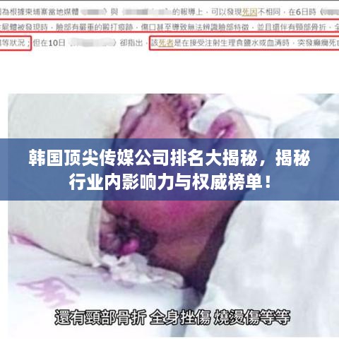韓國頂尖傳媒公司排名大揭秘，揭秘行業(yè)內(nèi)影響力與權(quán)威榜單！