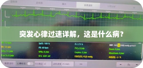 突發(fā)心律過速詳解，這是什么?。? class=