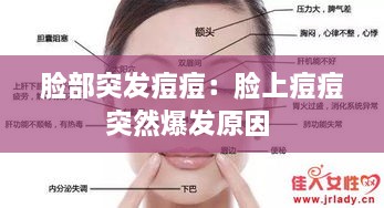 臉部突發(fā)痘痘：臉上痘痘突然爆發(fā)原因 