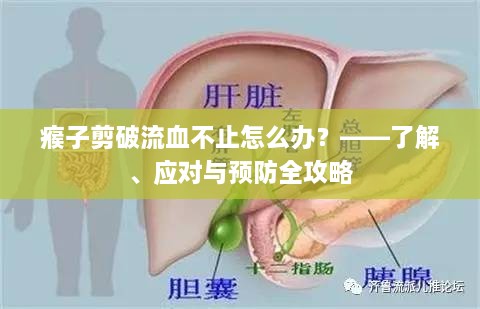 瘊子剪破流血不止怎么辦？——了解、應(yīng)對與預(yù)防全攻略