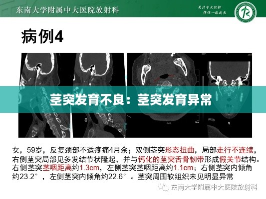 莖突發(fā)育不良：莖突發(fā)育異常 