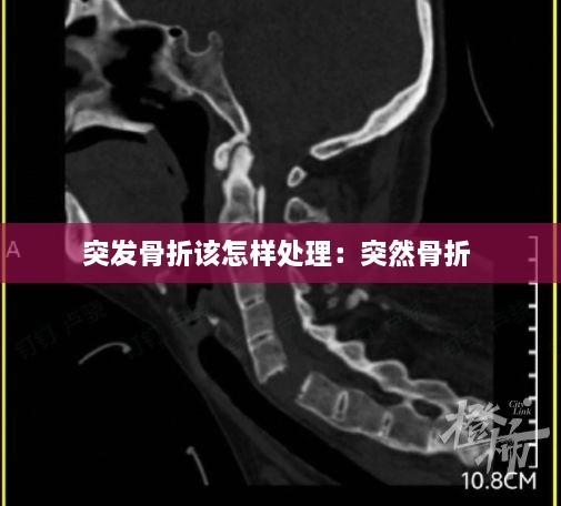 突發(fā)骨折該怎樣處理：突然骨折 